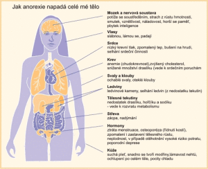 anorexie - potíže